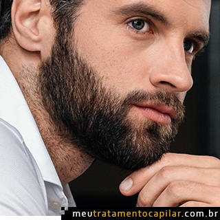 Implante de barba Tudo o que voc precisa saber sobre isso