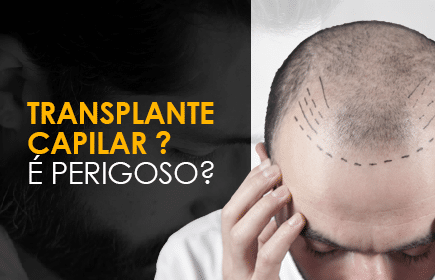 Transplante capilar é perigoso?